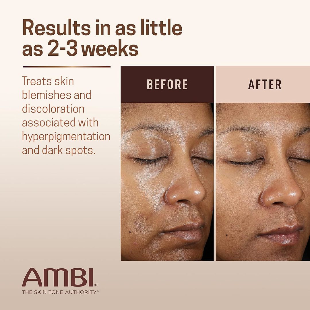 AMBI EVEN & CLEAR FADE CREAM ALL 1oz